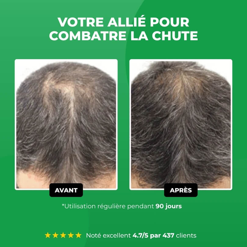 Traitement Anti-Chute Gents