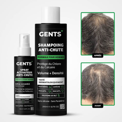 Traitement Anti-Chute Gents