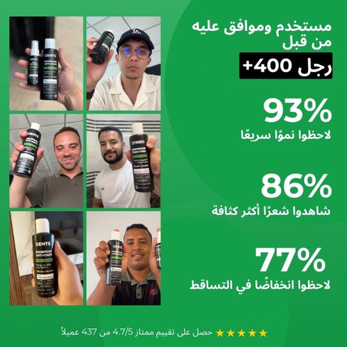 علاج تساقط الشعر - Gents